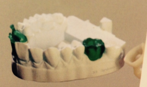 dientes